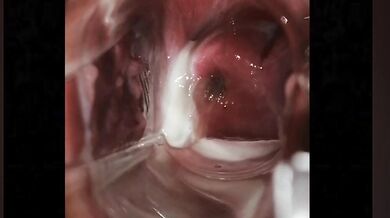 様々な接写で膣内が丸見え、全開！
